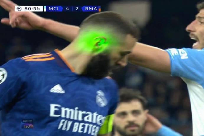Benzema bị CĐV Man City chơi xấu